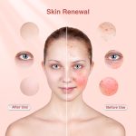 LED Red Light Near-Infrared Anti-Aging Facial Mask - Image 8